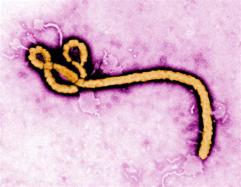 How U.S. Withdrawal from the (WHO) World Health Organization May Actually Create the Next Deadly Pandemic